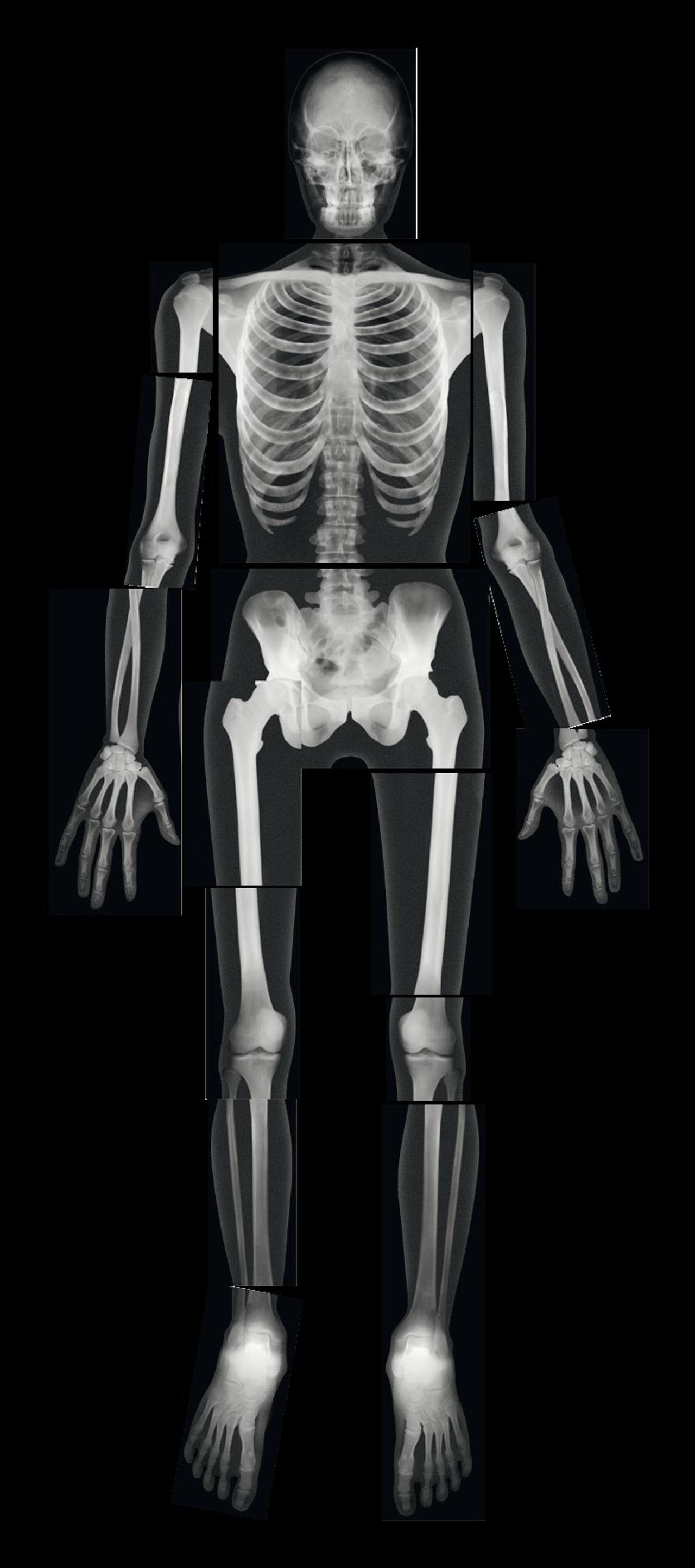 Röntgenbilder komplett människa 18 delar | Skola och förskola - Klassrummet / Lära - Anatomi | Kontorsexperten