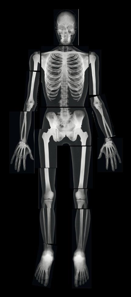 Röntgenbilder komplett människa 18 delar | Skola och förskola - Klassrummet / Lära - Anatomi | Kontorsexperten