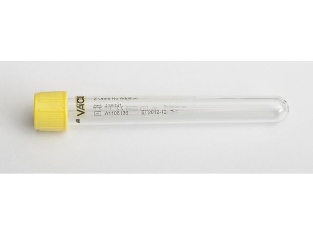 VACUETTE Provrör Vacuette Gul Urin 7/6,5ml 50/fp | Sjukvård och omsorg - Lab och analys - Provrör - Vacuette | Kontorsexperten